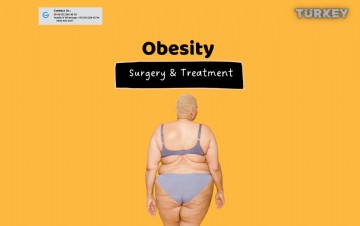 Why Choose Turkey for Obesity Surgery?