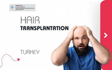 Turkey for Hair Restoration