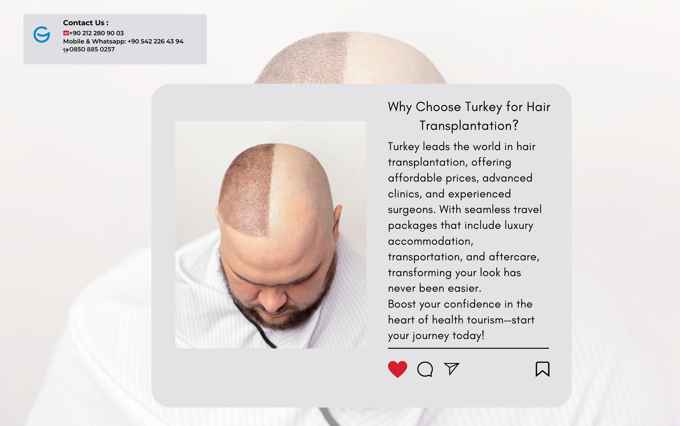 ¿Por qué elegir Turquía para el trasplante de cabello?