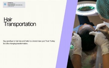 Discover the Ultimate Hair Transplant Experience in Turkey!