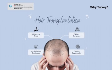 Turkey! A Leading Destination For Hair Transplantation