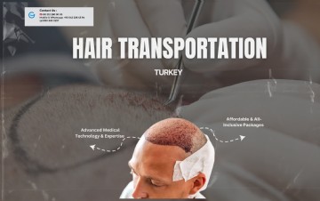 Hårtransplantation i Tyrkiet Excellence og overkommelig pris